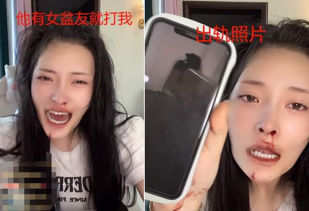 刘叉叉团队网红叉小辉家暴事件是怎么回事，女友网红大琳被家暴鼻血不止