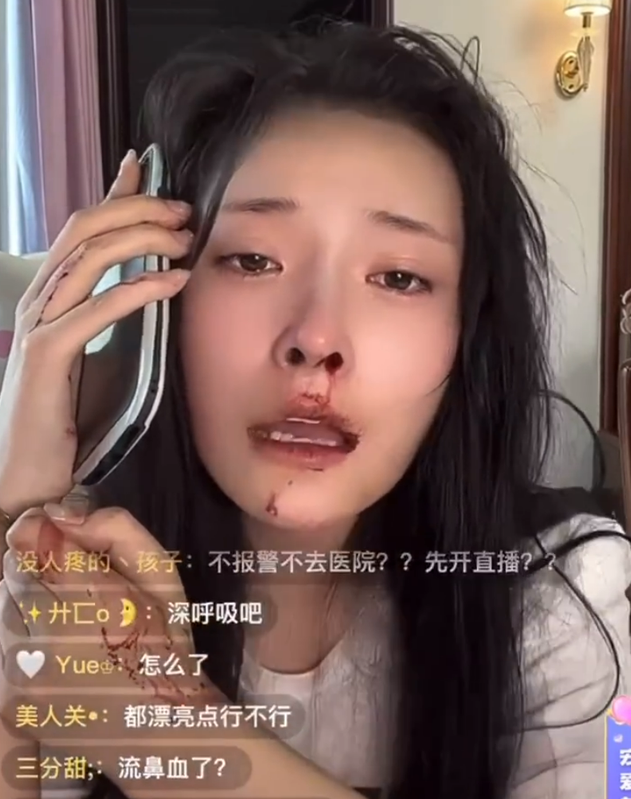 刘叉叉团队网红叉小辉家暴事件是怎么回事，女友网红大琳被家暴鼻血不止